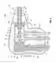 Fig. 04 - Microwave tissue dissection and coagulation