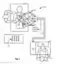 Fig. 02 - Control system for reducing internally generated frictional and inertial resistance to manual positioning of a surgical manipulator