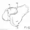 Fig. 01 - Method of determining a contour of an anatomical structure and selecting an orthopaedic implant to replicate the anatomical structure