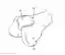 Fig. 03 - Method of determining a contour of an anatomical structure and selecting an orthopaedic implant to replicate the anatomical structure