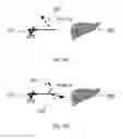 Fig. 07 - Device and method for assisting laparoscopic surgery rule based approach