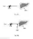 Fig. 08 - Device and method for assisting laparoscopic surgery rule based approach