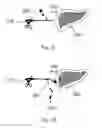 Fig. 09 - Device and method for assisting laparoscopic surgery rule based approach