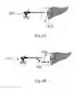 Fig. 10 - Device and method for assisting laparoscopic surgery rule based approach