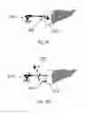 Fig. 11 - Device and method for assisting laparoscopic surgery rule based approach