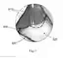 Fig. 12 - Device and method for assisting laparoscopic surgery rule based approach