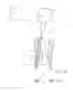 Fig. 07 - Endodontic instrument for drilling the root canals of a tooth