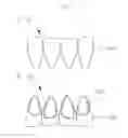 Fig. 03 - TEMPORARY RESIN-BASED CROWN