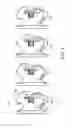 Fig. 03 - Kit of self-ligating brackets