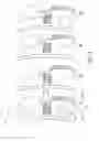 Fig. 04 - Kit of self-ligating brackets