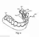 Fig. 07 - DIGITAL DENTISTRY