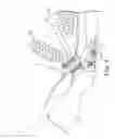 Fig. 04 - TRANSOBTURATOR METHODS FOR INSTALLING SLING TO TREAT INCONTINENCE, AND RELATED DEVICES