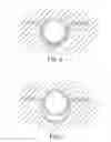 Fig. 05 - TRANSOBTURATOR METHODS FOR INSTALLING SLING TO TREAT INCONTINENCE, AND RELATED DEVICES