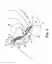 Fig. 04 - Implants, tools, and methods for treatment of pelvic conditions