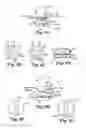Fig. 06 - Implants, tools, and methods for treatment of pelvic conditions