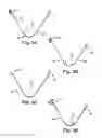 Fig. 07 - Implants, tools, and methods for treatment of pelvic conditions