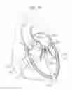 Fig. 11 - Dual-flange prosthetic valve frame