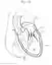 Fig. 12 - Dual-flange prosthetic valve frame