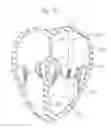Fig. 14 - Dual-flange prosthetic valve frame