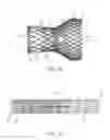 Fig. 02 - Rapid exchange transcatheter valve delivery system