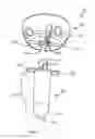 Fig. 03 - Radial head trials