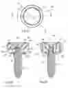 Fig. 07 - Radial head trials