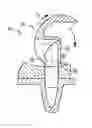 Fig. 01 - Knee prosthesis including rotatable spine