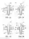 Fig. 03 - Knee prosthesis including rotatable spine