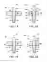Fig. 04 - Knee prosthesis including rotatable spine