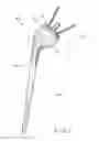 Fig. 02 - Shoulder arthroplasty system
