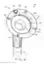 Fig. 05 - Shoulder arthroplasty system