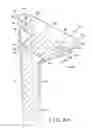 Fig. 09 - Shoulder arthroplasty system