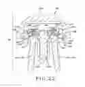 Fig. 21 - Shoulder arthroplasty system