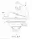 Fig. 23 - Shoulder arthroplasty system