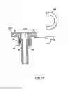 Fig. 20 - Expandable Vertebral Prosthesis