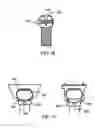 Fig. 21 - Expandable Vertebral Prosthesis
