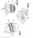 Fig. 06 - Vertebral implants and related methods of use