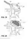 Fig. 11 - Vertebral implants and related methods of use