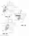 Fig. 15 - Vertebral implants and related methods of use