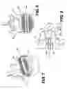 Fig. 06 - Vertebral implants and related methods of use