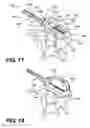 Fig. 10 - Vertebral implants and related methods of use