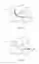 Fig. 05 - Minimally invasive spinal fusion system and method