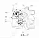 Fig. 08 - Minimally invasive spinal fusion system and method