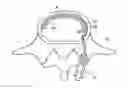 Fig. 01 - In-situ formed intervertebral fusion device and method