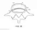 Fig. 07 - In-situ formed intervertebral fusion device and method