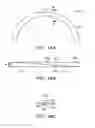 Fig. 25 - In-situ formed intervertebral fusion device and method