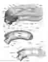 Fig. 05 - Articulating expandable intervertebral implant