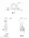 Fig. 06 - Instruments and methods for removing fixation devices from intervertebral implants