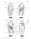 Fig. 05 - Dorsi-plantar prosthetic ankle module