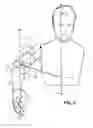 Fig. 04 - Coordinated control for an arm prosthesis